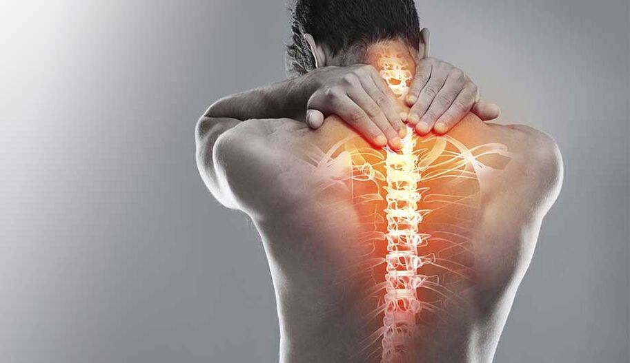 Bol u kralježnici zbog osteohondroze