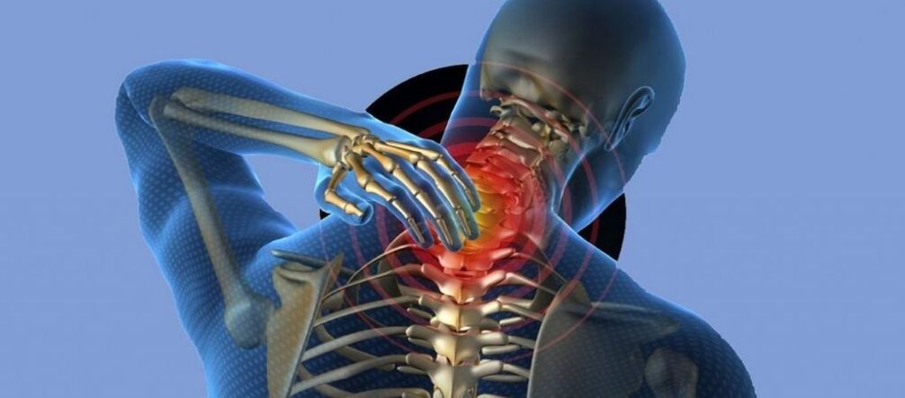 Osteohondroza grlića maternice